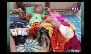 Embedded thumbnail for Child seriously injured in a landmine explosion in Thaton Township, January 2021